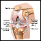Knee arthroscopy  - series